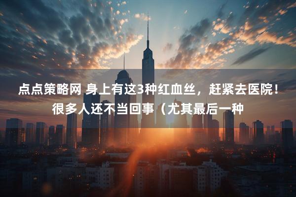 点点策略网 身上有这3种红血丝，赶紧去医院！很多人还不当回事（尤其最后一种